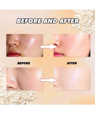 2PCS Rice Exfoliating Serum for Face - Gentle Peel & Brightening Essence Deep Cleanse Vegan Formula - Buy Online on GoSupps.com