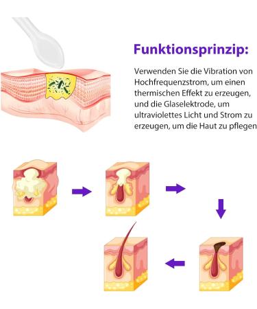 Yorking High Frequency Facial Device - Acne Treatment Electrotherapy Beauty Instrument for Radiant Skin - Buy Online on GoSupps.com