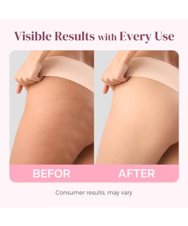 Solivetta Butt Tight Lift and Firm Booty Cellulite Cream - Smooth & Sculpt Booty Thighs Belly & Arms | LIFTONIN Skin Firming & Toning Bum Mask 3.72 fl oz - Buy Online on GoSupps.com
