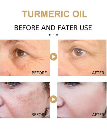 Turmeric Facial Essence Dark Spot Removal Brightening Oil Serums Natural Moisturizer Power Repairing Conditioner 101 Fl Oz Facial Moisturizing Essence for Dry Qihuyi - Buy Online on GoSupps.com
