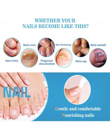 MAMaiuh Nail Repair Bio-Pen for Fragile Nails - Men and Women (Blue) - Buy Online on GoSupps.com