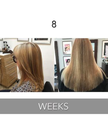 Biotin Hair Growth Conditioner - High Potency Anti Hair Loss Treatment with Vitamins E, A, and C - 8.5 Ounce - Buy Online on GoSupps.com