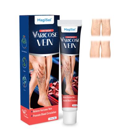 MagiSel Varicose Vein Cream Cream Against Spider Veins Varicose Vein Leg Care Cream 20g Spider Vein Varicose Vein Cream for Legs Eliminates Varicose Veins and Spider Veins