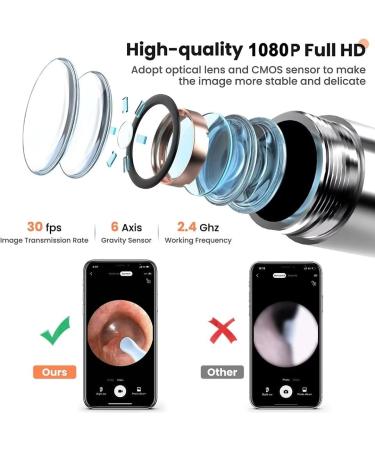 Ear Wax Removal Camera and Light Kit - 1080P Ear Cleaner for iOS & Android - 8 Pcs Ear Set Included - Buy Online on GoSupps.com