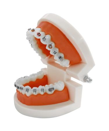 Dental Orthodontic Teeth Model with Colorful Braces Professional Denture Mouth Model Demonstration Study Tool for Dentistry Students and Orthodontists Tooth Teaching Equipment with Bracket Supplies