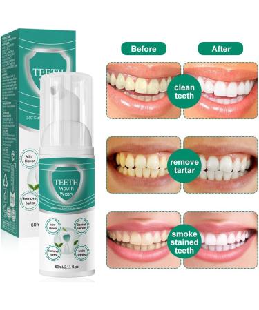 Foam Toothpaste & Whitening Mouthwash | Ultimate Oral Care & Deep Cleaning - Buy Online on GoSupps.com