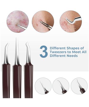 15 PCS Pimple Popper Tool Kit | Blackhead Remover & Acne Extractor Set with Metal Case - Buy Online on GoSupps.com
