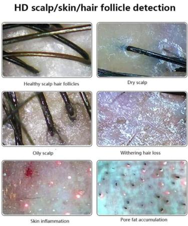 Scalp Detector Skin Diagnosis Hair Analyzer 15 Inch Screen Digital Skin Detector Moisture Tester Hair Skin Analyzer Machine for Home Beauty Salon Spa - Buy Online on GoSupps.com