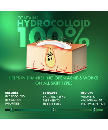 Acne Pimple Patch - 72 Invisible Hydrocolloid Stickers for Overnight Acne Treatment | Fast-Absorbing Patch for Clear Skin - Buy Online on GoSupps.com