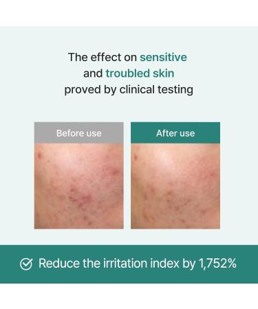 Licorice Soothing Ampoule - 73% Korean Licorice & Exosome | Non-Comedogenic Skin Care 1.01 Fl Oz - Buy Online on GoSupps.com