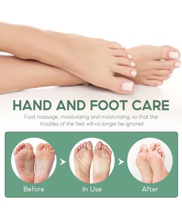 Urea 40% Foot Cream Tea Tree Urea Foot Cream Urea Foot Cream 40% Cracked Heel Repair Cream 40% Urea Cream Intensive Exfoliating Foot Cream Foot Cream for Cracked Heels and Dry Skin - Buy Online on GoSupps.com