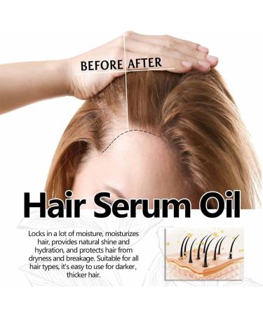 Neviux Natural Hair Growth Oil - Hair Growth Oil 2024 New Natural Hair Oil Rosemary Oil for Hair Growth Hair Growth Oil Prevent Hair Loss Improves Damaged Hair Hair Oil for Thin Hair Dry Damaged Hair - Buy Online on GoSupps.com