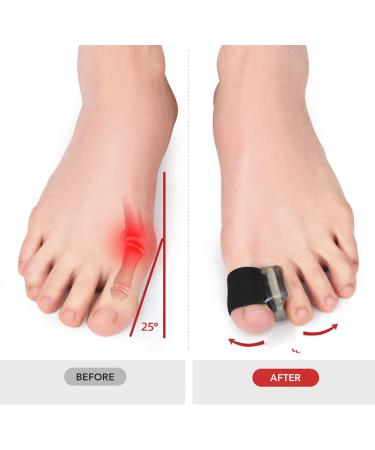 Professional Toe Spacers Bunion Corrector - 6 Pairs for Men and Women - Buy Online on GoSupps.com