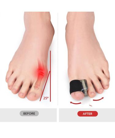Bunion Corrector Toe Separators - 6 Pairs for Men - Professional Bunion Relief - Prevent Friction - Stable & Flexible - Buy Online on GoSupps.com