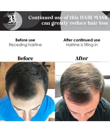 Made With Love Biotin & Collagen Hair Mask 8oz | Repair Dry & Damaged Hair | Aloe Vera Avocado Oil & Vitamin E - Buy Online on GoSupps.com