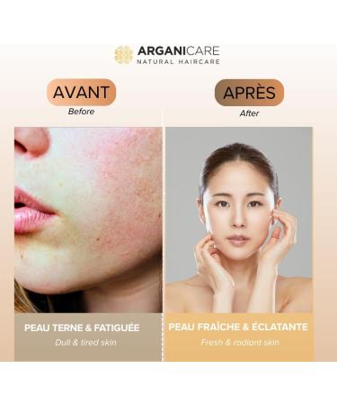  Arganicare Vitamin C Toning Micellar Water with Hyaluronic Acid and Aloe Vera Makeup Remover for All Skin Types 500 ml Shampoo - Buy Online on GoSupps.com