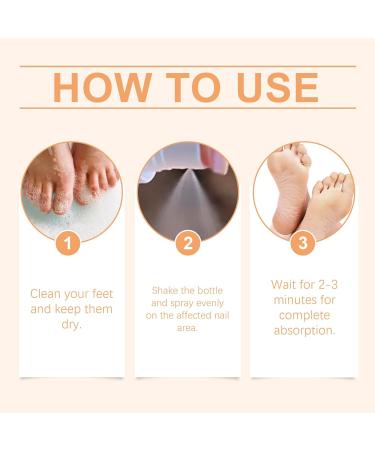 Bee Venom Nail Fungus Soothing Spray - Extra Strength Toenail Treatment (20ml) | Natural Nail Fungus Relief - Buy Online on GoSupps.com