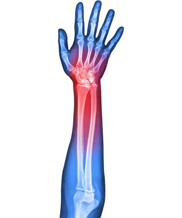 Buy Soles Wrist Splint Brace - Adjustable Comfortable Support for Pain Relief | International Shipping Available - Buy Online on GoSupps.com