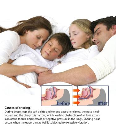 Snoring Patches: Sleep Tape for Better Nose Breathing, Improve Night Sleep - Buy Online on GoSupps.com
