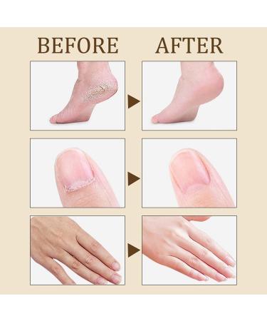 ENVVA Cracked Hands and Feet Cream Heel Balm Stick for Dry Cracked Feet Stick Heel Balm for Dry and Cracked Feet Intensive Moisturizing Foot Care - Buy Online on GoSupps.com