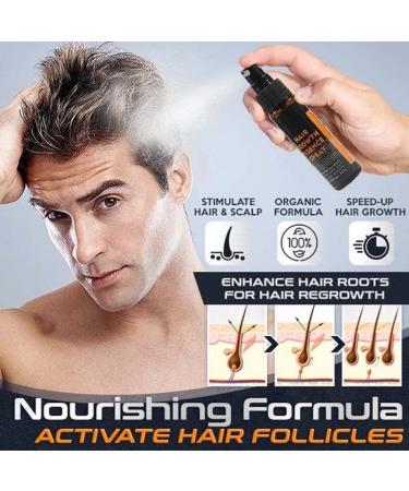 Bio Tech Advanced Regrowth Treatment Kit | Hair Growth Serum & Roller Essence Set for Women | Anti Hair Loss Solution - Buy Online on GoSupps.com