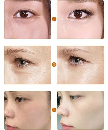 30pcs Capsule de S rum R tinol Correxion R duisant les Rides claircissantes Revitalisantes pour les Soins de la Peau Hydratant produits soins la peau Capsule hydratante pour le visage - Buy Online on GoSupps.com