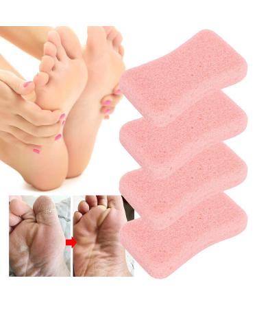 Buy 4 Pack Pumice Stone for Feet - Callus Remover & Pedicure Scrubber (Pink) | Softens & Smooths Hard Skin for Hands & Body - International Shipping Available - Buy Online on GoSupps.com