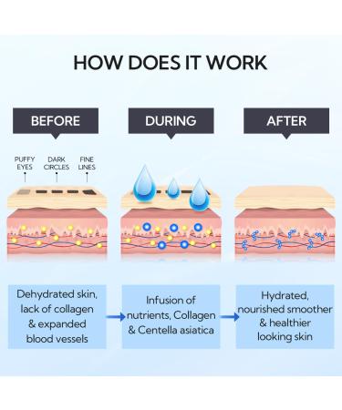 LANBENA Hyaluronic Acid Eye Mask - Collagen Patches for Dark Circles & Eye Bags (30 Pairs) - Hydrating Skin Care - Buy Online on GoSupps.com