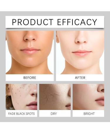 Turmeric Body Cream Moisturizer Moisturizing Body Cream Light & Nonsticky For Skin & Smooth Texture2pcs - Buy Online on GoSupps.com