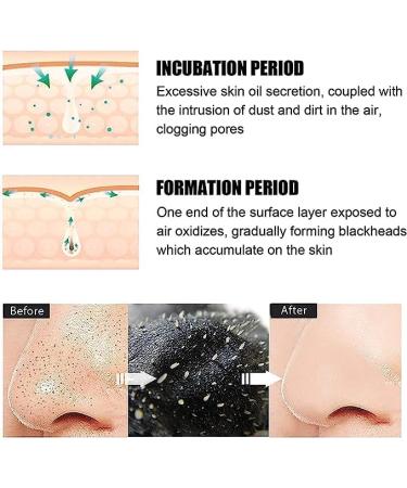 10 Pcs Benzoyl Peroxide Blackhead Remover Nose Strips for Face and Pores - Buy Online on GoSupps.com