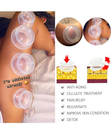 6 Sizes Silicone Cupping Therapy Set - Strong Suction for Myofascial Massage, Pain Relief - Professional Studio and Household Cupping Kit - Buy Online on GoSupps.com