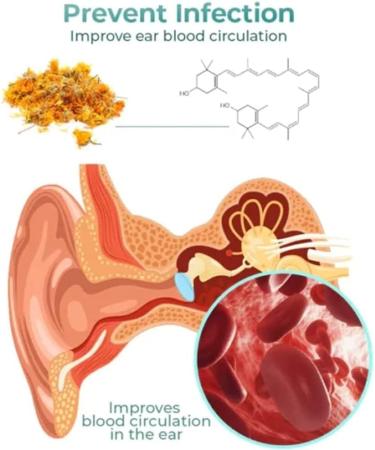 ALASSE GFOUK Earwax Softener & Remover Spray - 3 Pack for Effective Cochlear Blockage Removal - Buy Online on GoSupps.com