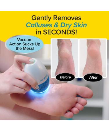 Pedi Vac by Ped Egg - Electric Callus Remover with Built-in Vacuum for Mess-Free Exfoliation - Buy Online on GoSupps.com