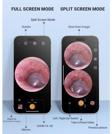 AnyScope HD Digital Otoscope Video Ear Scope Otoscope with Light Ultra Clear View Ear Camera with Ear Wax Removal Tools Compatible with iPhone and Android Devices (Silver)  - Buy Online on GoSupps.com