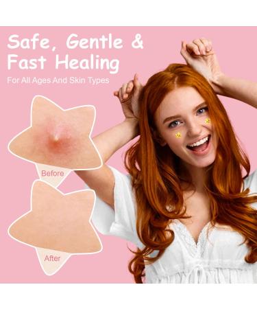 Acne Patch Pimple Patch - Hydrocolloid Dots to Reduce Zits Blemishes & Inflammation | 126 Count - Buy Online on GoSupps.com
