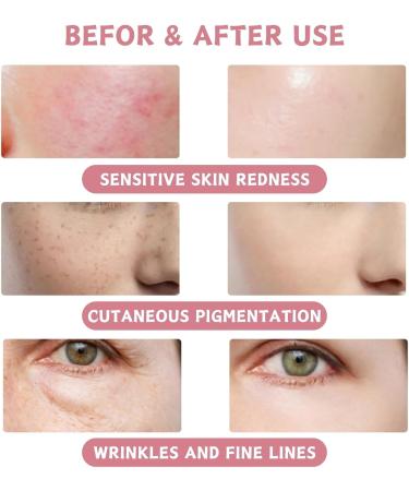 Face Masks Beauty - Rose & Hyaluronic Acid Jelly Mask - Face Masks Beauty for Deep Cleansing Hydrating & Nourishing - Face Care for Reducing Acne & Removing Dark Spots - Peel Off Face Masks - Buy Online on GoSupps.com