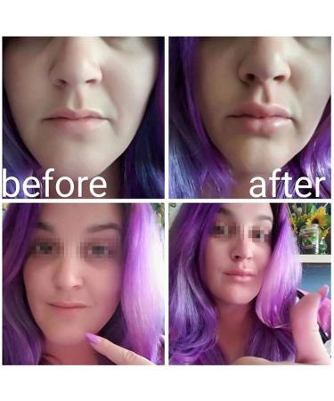 Buy Women s Fish Shape Lip Plumper Beauty Tool - Enhance Your Lips | International Shipping Available - Buy Online on GoSupps.com