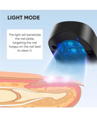 Buy Nail Fungus Light Device for Home Use - Treat Onychomycosis on Fingernails & Toenails | Effective for Damaged Discolored & Thickened Nails - Buy Online on GoSupps.com