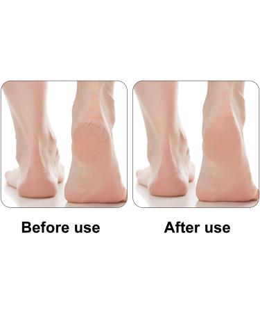 Pumice Stone Natural Foot Pumice Stone Hard Skin Callus Remover Stone with Uniform Structure Callus Remover Stone 2 Sided Foot Exfoliator Scrubber Lightweight Callus Remover for Dead Skin. Random Color - Buy Online on GoSupps.com