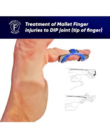 Finger Splint for Broken Fingers & Fractures | Trigger & Mallet Finger Straightener - International Shipping Available - Buy Online on GoSupps.com