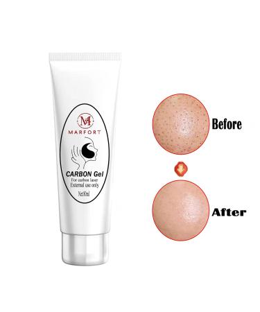 Buy Carbon Peel Cream Gel for Facial Rejuvenation - Black Doll Deep Cleaning & Effective Skin Treatment (80ml) | Worldwide Shipping - Buy Online on GoSupps.com