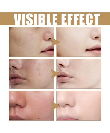 Rice Toner Rice Water Rice Face Toner Toner Skincare for Deep Hydration Smoothing Toner Natural Moisturizer Glow Essence Facial Toner Hydrating Toner for Face Moisturizing Rice Extract 150ML - Buy Online on GoSupps.com