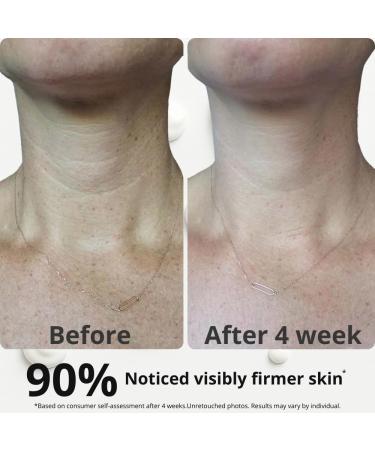 Neck Tightening Cream with Argireline AH-8 Bakuchiol Hyaluronic Acid & Alpha Arbutin Firming Moisturizer for Face Neck & D collet Anti-Wrinkle Cream for Women & Men 1.76 Oz - Buy Online on GoSupps.com