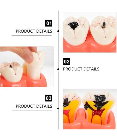 Ultechnovo 2PCS Pathological Teeth Display Model for Dental Training - Endodontic Caries Tool 12.5x7x6.5cm - Ideal for Dentists & Students - Buy Online on GoSupps.com