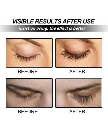 Eyelash & Brow Growth Serum - Fast Irritation-Free Lash Booster for Dense Long Lashes & Eyebrows (5 ml - Buy Online on GoSupps.com