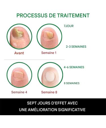  G n rique Toenail Gel | 20ml Repair Cream for Thick Nails | Moisturizing Care for Thick Hard Sensitive Dry and Cracked Nails for Men and Women | Daily Use Home Travel Nighttime Shower - Buy Online on GoSupps.com