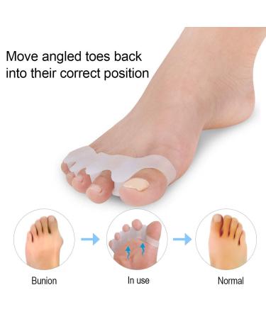 2 Pair Gel Bunion Corrector for Kids | Toe Separator & Pain Relief for Overlapping Toes - Buy Online on GoSupps.com