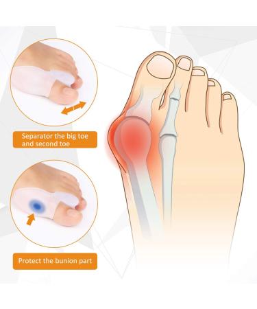 Gel Big Toe Bunion Guard Kit - Men and Women Bunion Corrector & Straightener for Hammer Toe. Ideal for Running & Sleeping - Day/Night Treatment - Buy Online on GoSupps.com