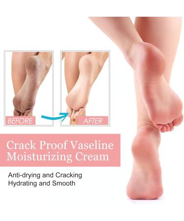 Cracked Heel Repair Cream Stick Foot Moisturizing Stick Foot Cream For Very Dry Feet Foot Cream For Calluses And Hard Skin Foot Moisturiser Callus Remover Soften For Feet Knees Hand - Buy Online on GoSupps.com