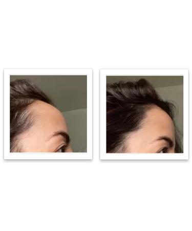 Caboki 10X Volumizing Hair Powder - Talc-Free Dark Gray | Root Touch Up for Thinning Hair | Cover Bald Spots for Men & Women - Buy Online on GoSupps.com